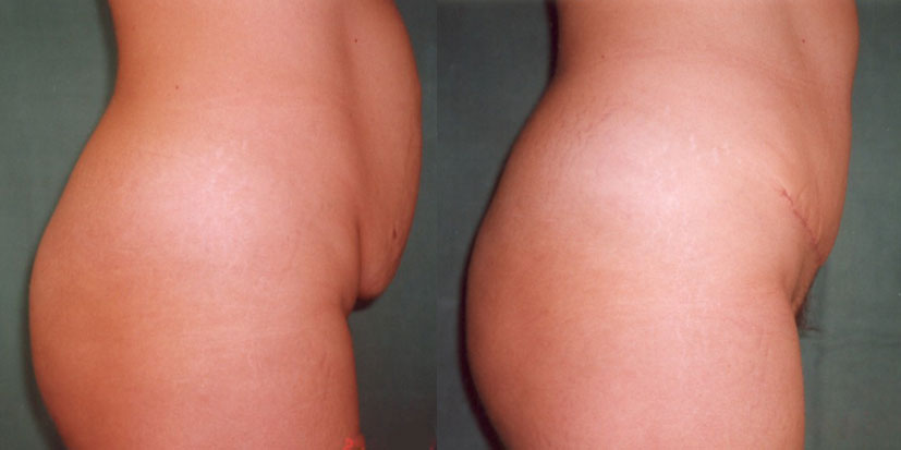 plastická chirurgie